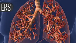 Image via MedPage Today