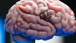 Image via ScienceDaily