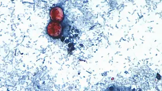 Image via MedPage Today