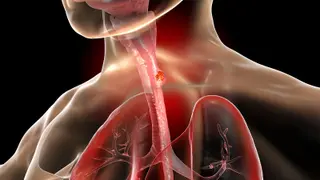 Image via MedPage Today