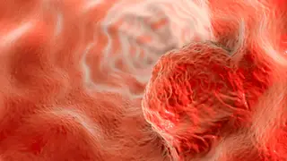 Image via MedPage Today