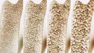 Image via ScienceDaily