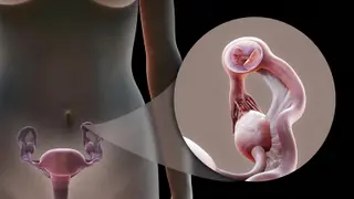 Image via MedPage Today