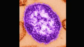 Image via MedPage Today