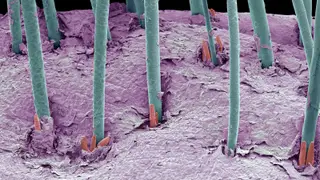 Image via MedPage Today