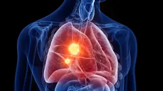 Image via ScienceDaily
