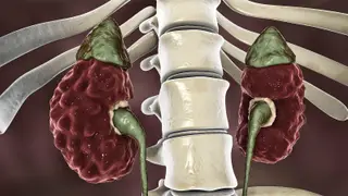 Image via MedPage Today