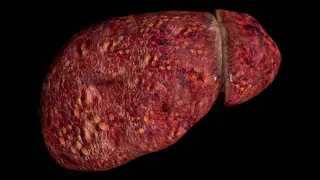 Image via MedPage Today