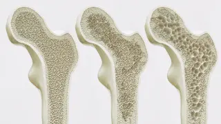 Image via ScienceDaily