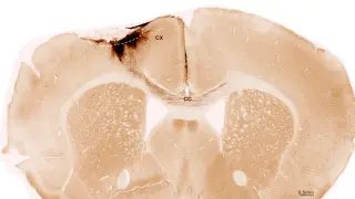 Image via ScienceDaily