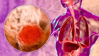 Image via MedPage Today