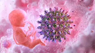 Image via MedPage Today
