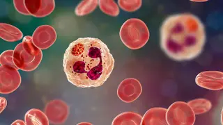 Image via MedPage Today
