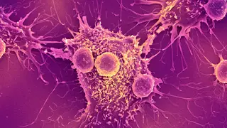 Image via Scientific American