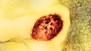 Image via Global Biodefense