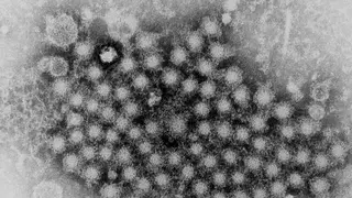 Image via Global Biodefense