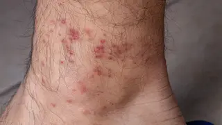 Image via MedPage Today