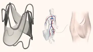 Image via MedPage Today