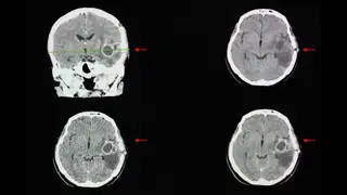 Image via MedPage Today