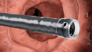 Image via MedPage Today