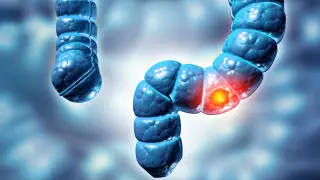 Image via ScienceDaily