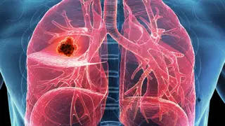 Image via MedPage Today