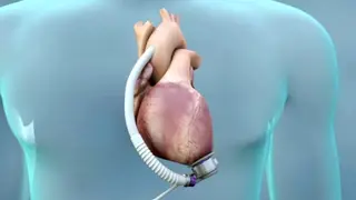 Image via MedPage Today