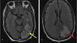 Image via ZME Science