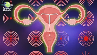 Image via Scientific American