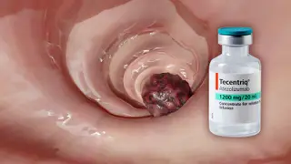 Image via MedPage Today