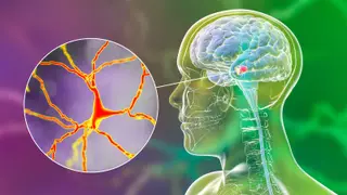 Image via MedPage Today
