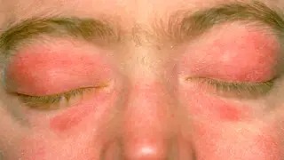 Image via MedPage Today