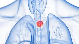 Image via MedPage Today