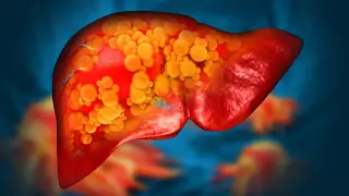 Image via ScienceDaily