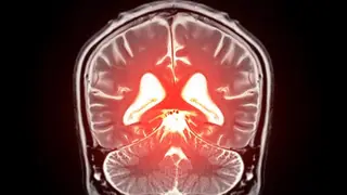Image via SciTechDaily