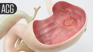 Image via MedPage Today