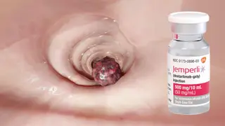 Image via MedPage Today